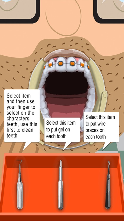 Geek Braces – Dentist Surgery Makeover (Kids Tooth Games) screenshot-3