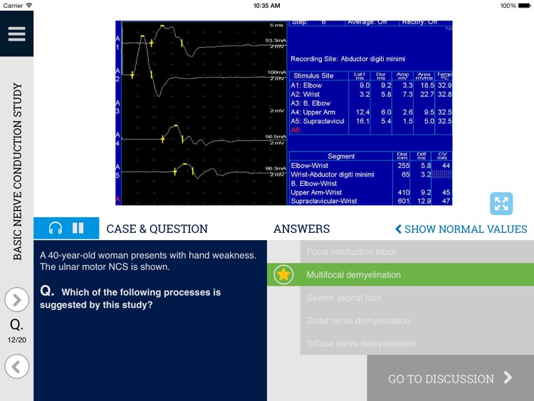 Learn EMG: An Interactive Quiz Approach to Electrodiagnostic Interpretation