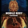 Mobile Body C