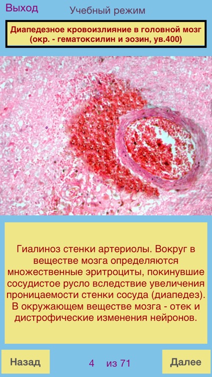 Патология