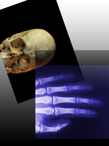 Faux Bone Imaging Scanner HD screenshot 2