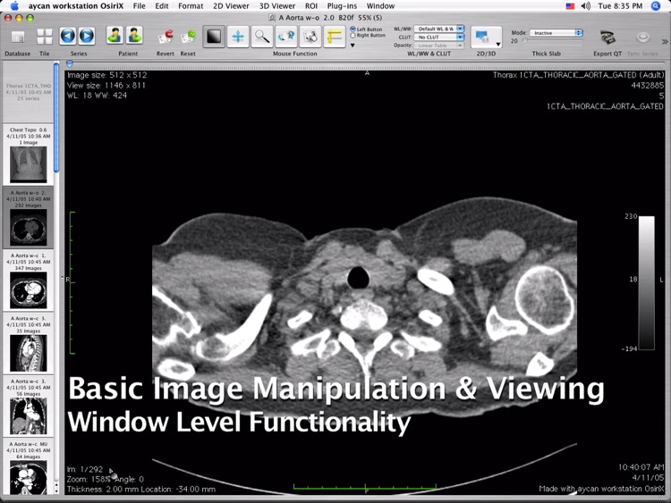 OsiriX PRO Full Tutorials