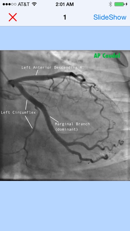 CathLab App screenshot-4