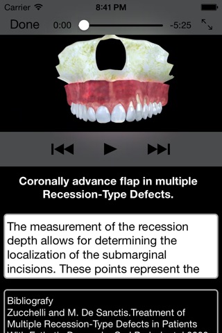 Periodontal Advanced Surgery By Mariano Sanz screenshot 3