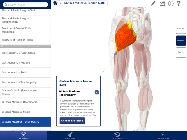 Rehabilitation for Lower Limbs(圖2)-速報App