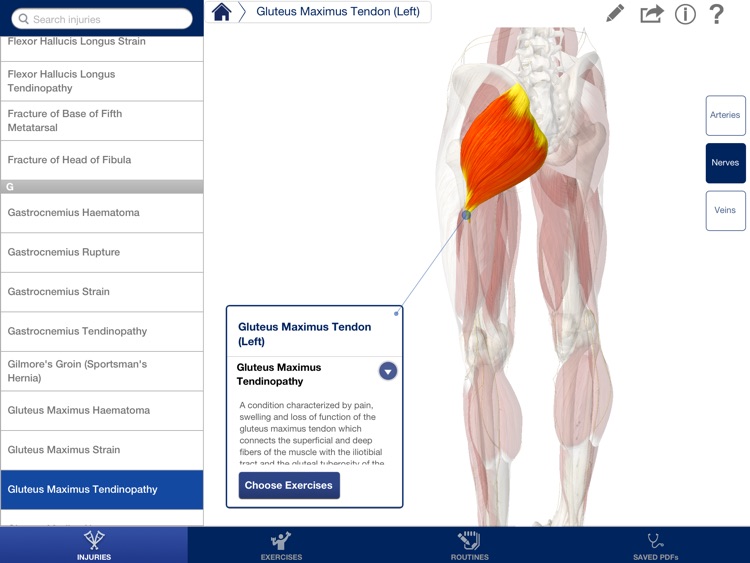 Rehabilitation for Lower Limbs