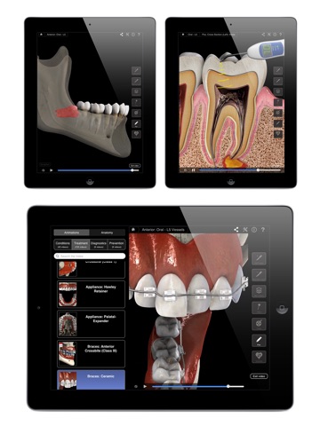 Dental Patient Education screenshot 2