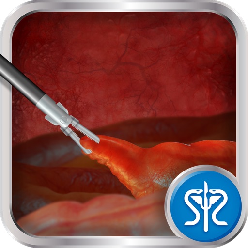 Surgery Squad's Virtual Appendectomy iOS App