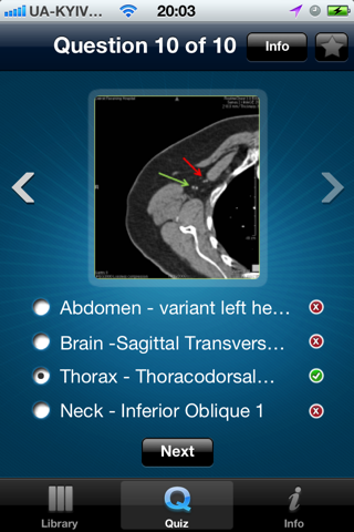 CT Scan screenshot 4