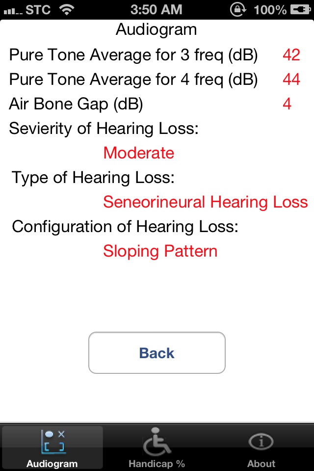 Audiogram Analyzer screenshot 3