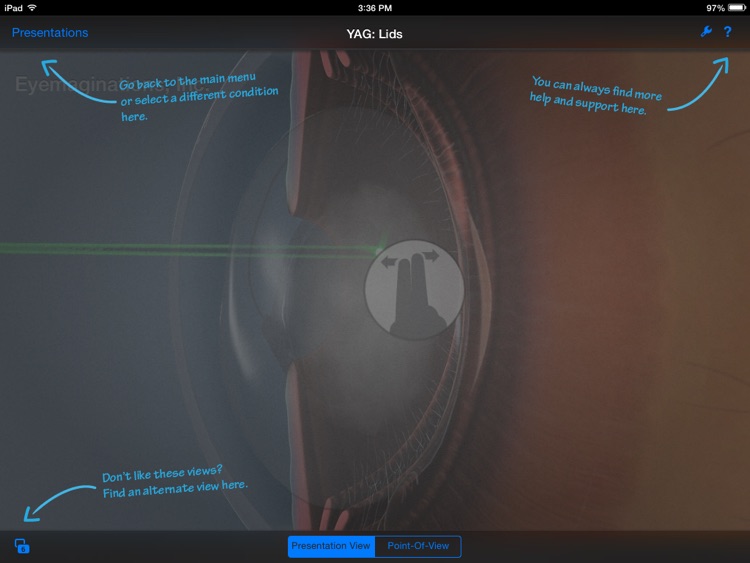 Echo IOL Simulator