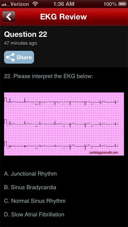 EKG Review