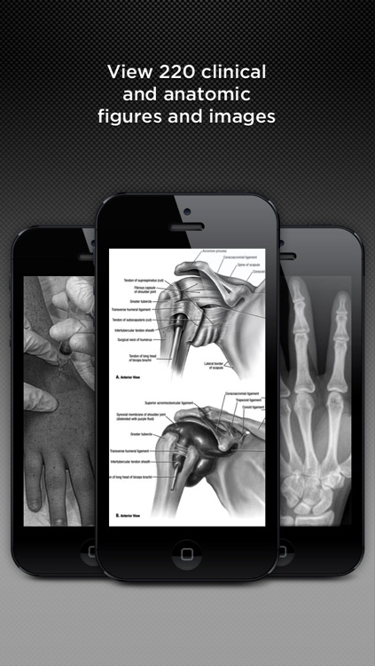 5-Minute Sports Medicine Consult