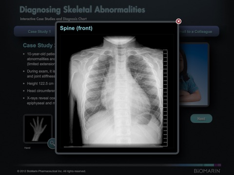MPS Differential Diagnosis screenshot 3