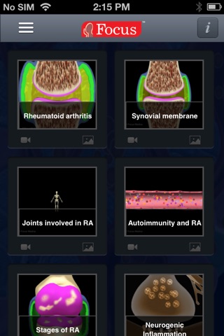 Atlas of Rheumatoid Arthritis screenshot 3