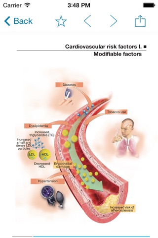 Miniatlas Acute Coronary Syndrome screenshot 4