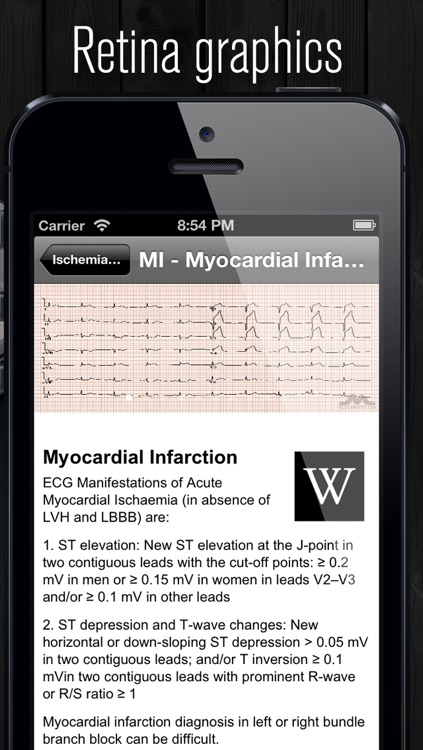 ECG Atlas