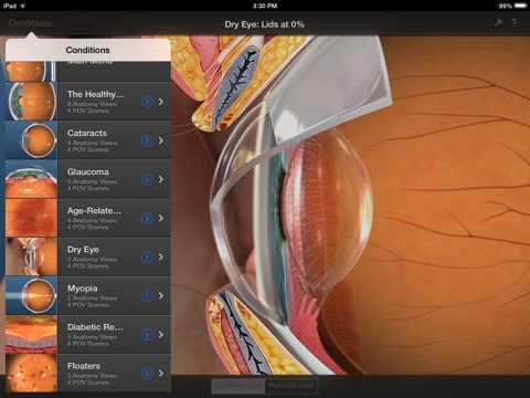 Echo Vision Simulator screenshot 2
