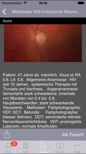 Atlas of Ophthalmology by Onjoph(圖5)-速報App