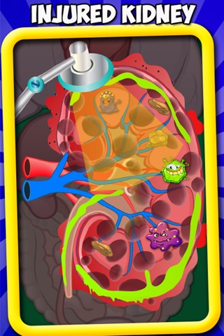 Kids Kidney Doctor – Amateur surgeon and kids doctor game with body X Ray screenshot 2