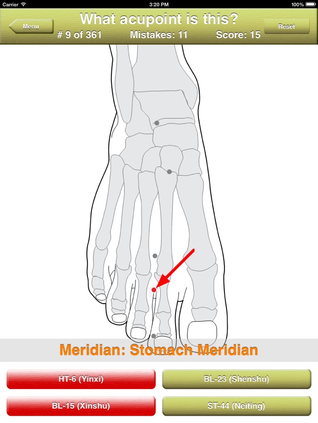 Acupoints Location Quiz(圖3)-速報App