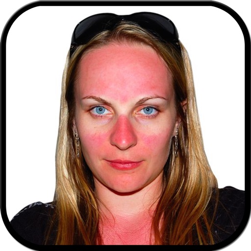 Sun Burn Face icon