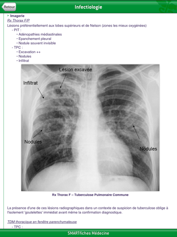 SMARTfiches Infectiologie Freeのおすすめ画像2