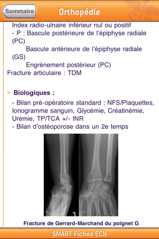 SMARTfiches Orthopédie Free screenshot 4