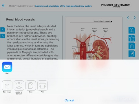 iMBODY Urology screenshot 4