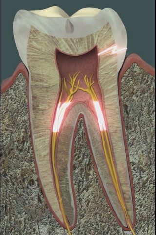 Dental Pain screenshot 2