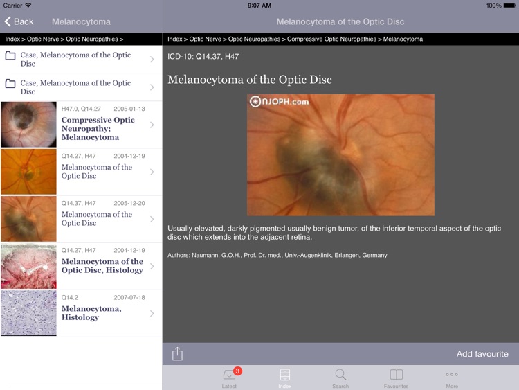 Atlas of Ophthalmology HD by Onjoph screenshot-1