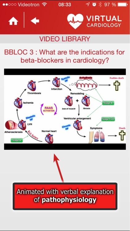 Virtual Cardiology by McGill University cardiologists and cardiologists from‎ Université Laval screenshot-4