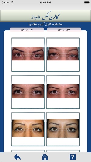 Eye Plastic Surgeries(圖3)-速報App