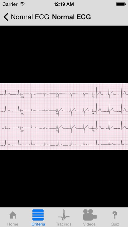 ECGsource
