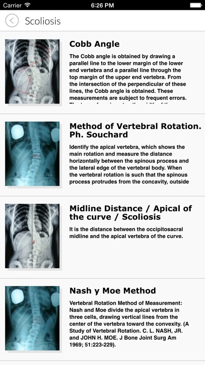 X-ray Measuring