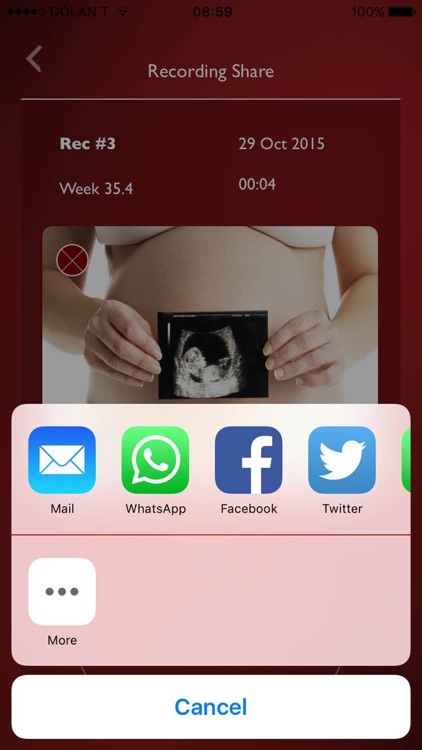 My Baby's Beat - Prenatal Listener screenshot-3