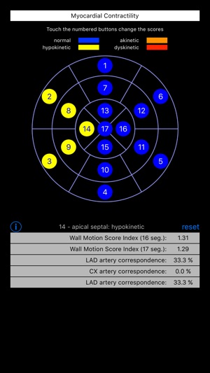 Wall Motion Score Index