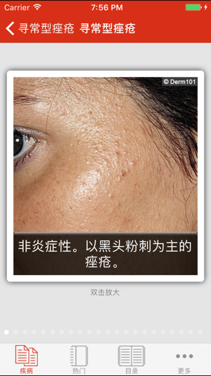 Derm101 Point of Care: 皮肤诊疗助手(圖5)-速報App