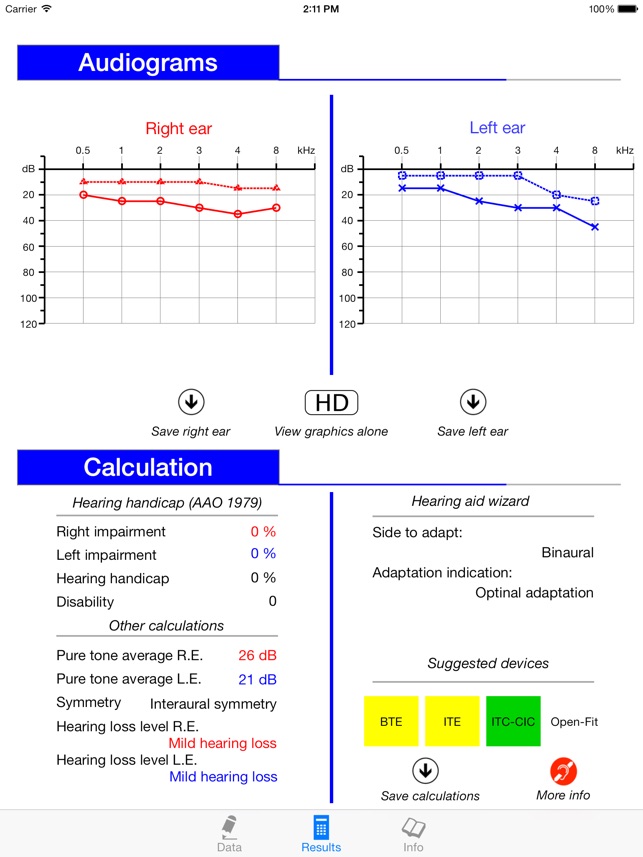 AudCal HD(圖2)-速報App