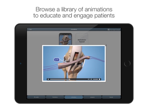 The Visual Consult: ACL Reconstruction screenshot 4