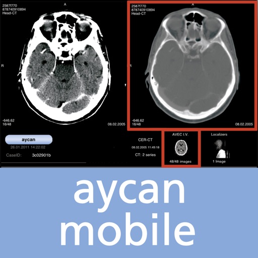 aycan mobile USA