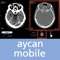 Demo account: User: aycan PW: aycan