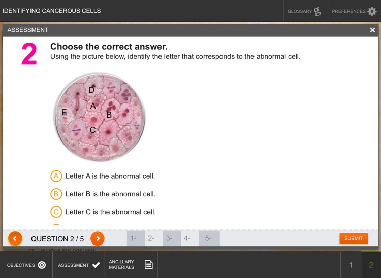 Identifying Cancerous Cells screenshot-4