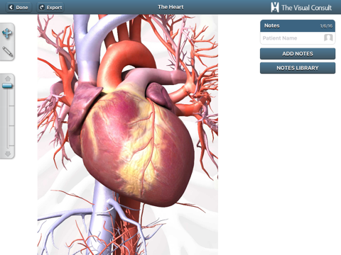 The Visual Consult: Cardiology screenshot 2