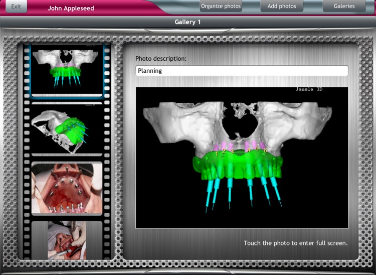 DentalChart screenshot-4