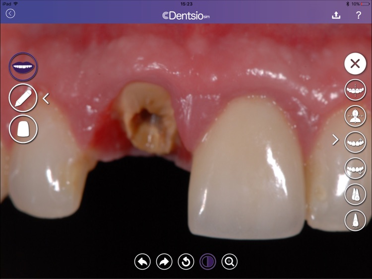 DentsioSim