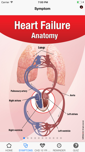 Signs & Symptoms Heart Attack(圖2)-速報App