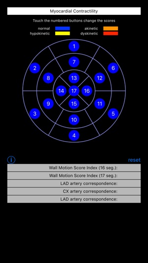 Wall Motion Score Index(圖4)-速報App