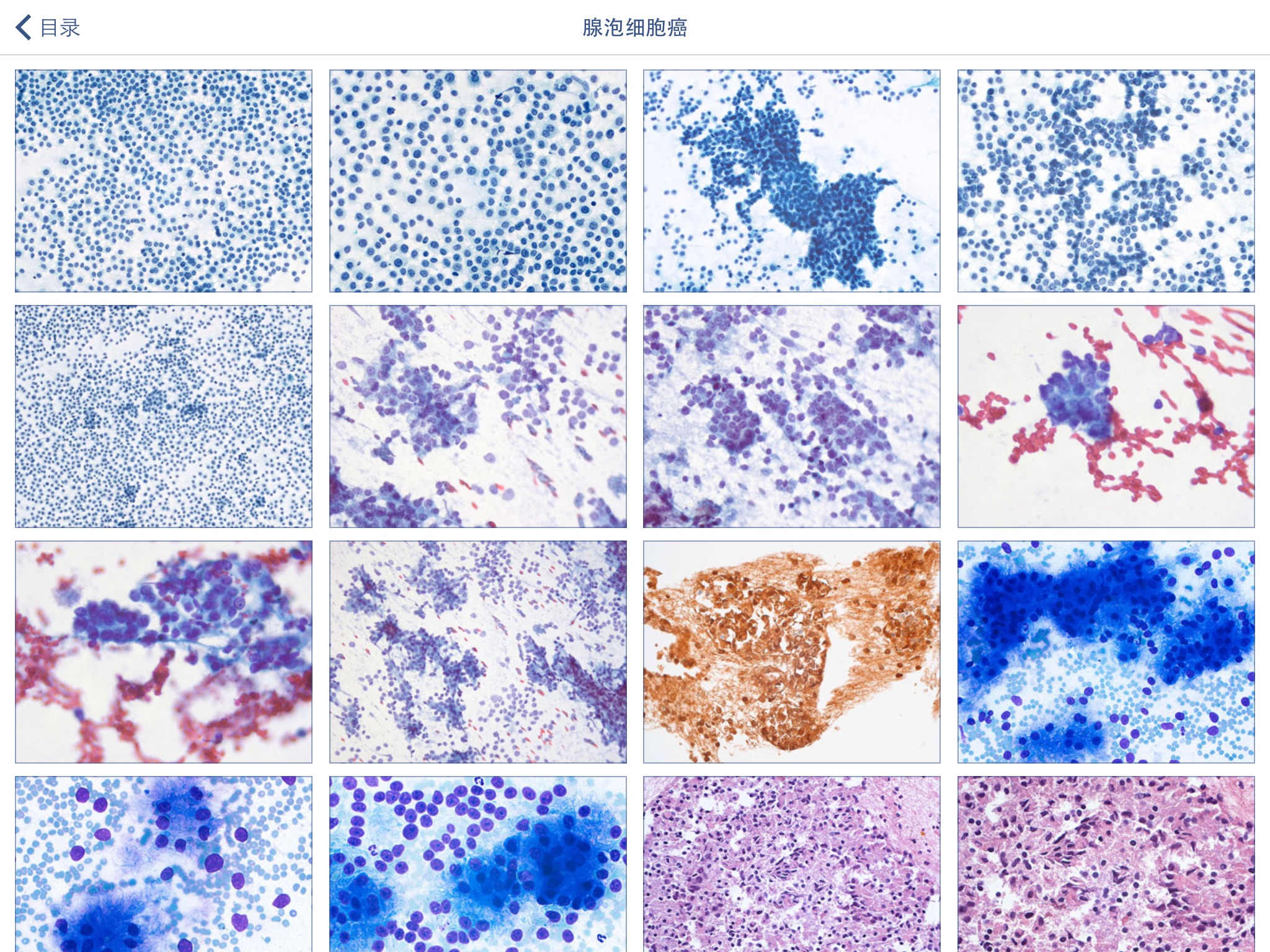 Johns Hopkins Atlas of Pancreatic Cytopathology screenshot 2