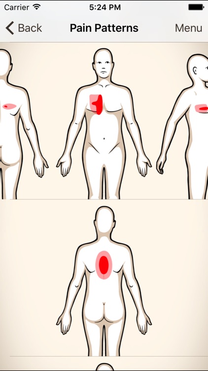 Clinical Pattern Recognition: Neck/Upper Back Pain